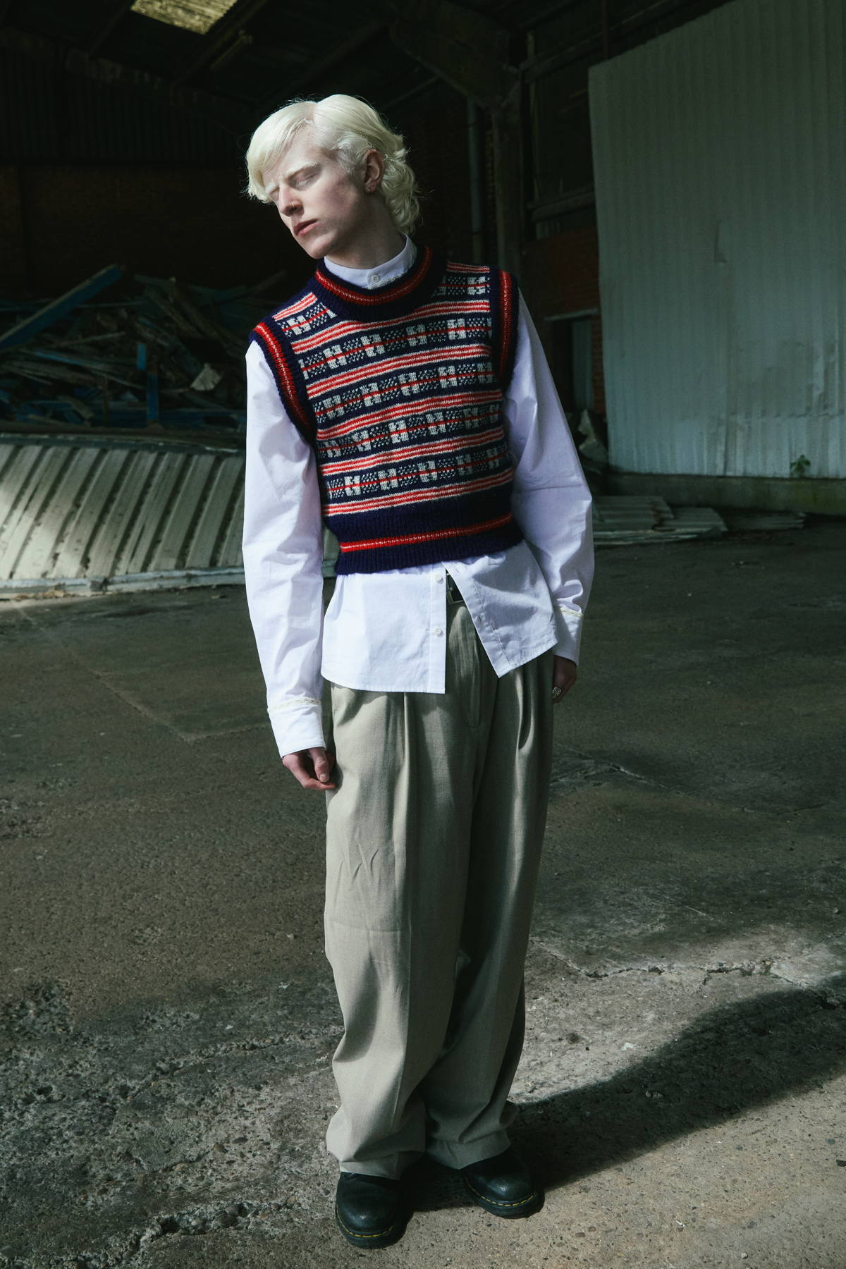 fashion editorial about the beauty of albinism